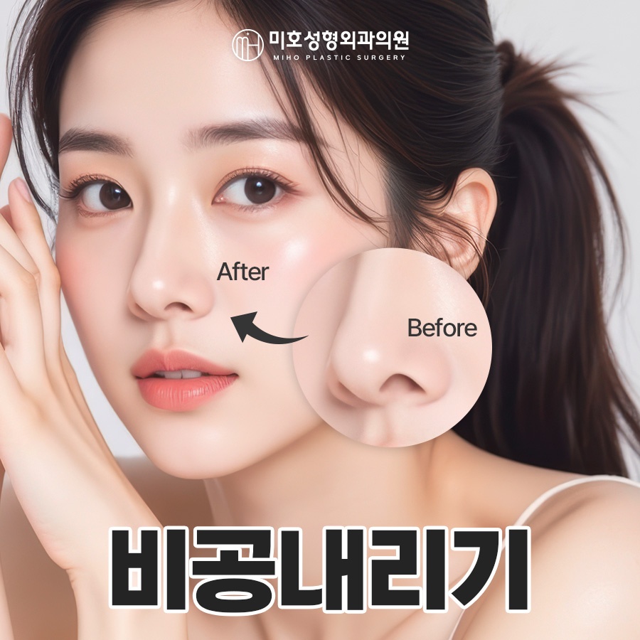Adjusting the Approach According to the Type of Nostril-Lowering Procedure image 1