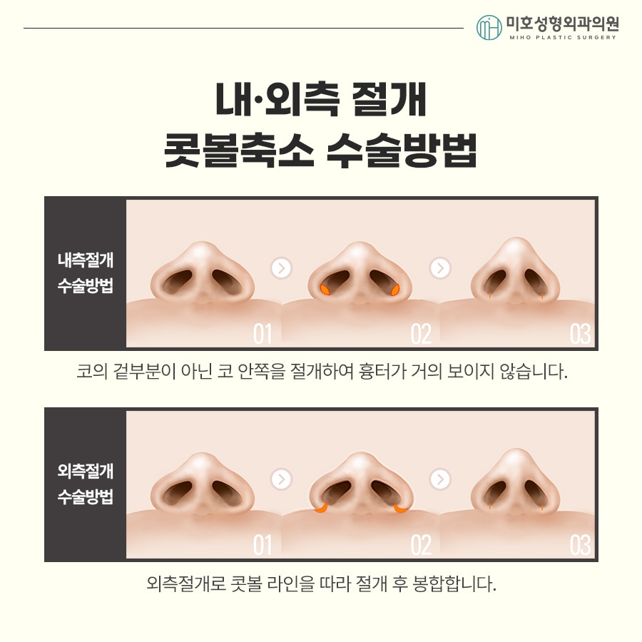 How to Make Your Nostrils Look Smaller: Considering Facial Harmony image 6