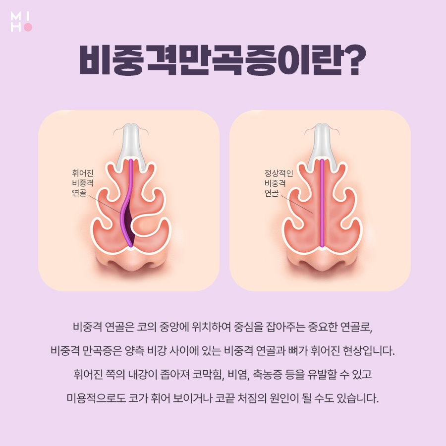 If You Are Curious About the Actual-Expense Insurance Claim Process for a Deviated Septum image 2