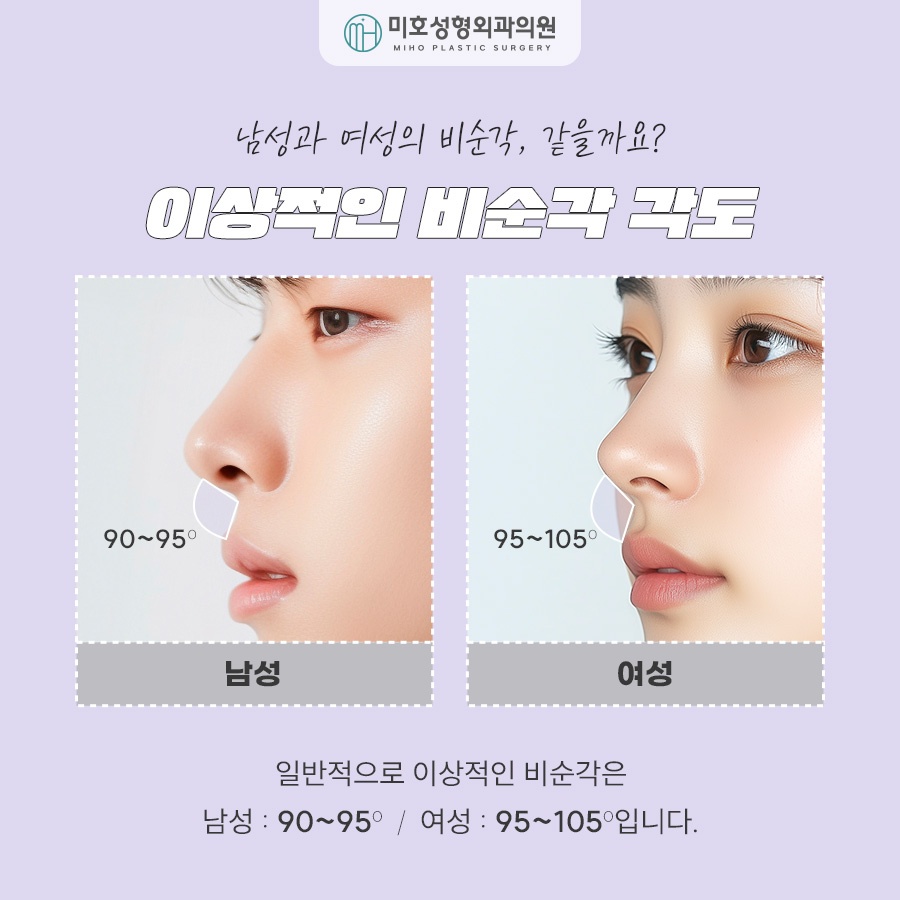 Nasolabial Angle Correction: Who Needs It and How Should It Be Done? image 4