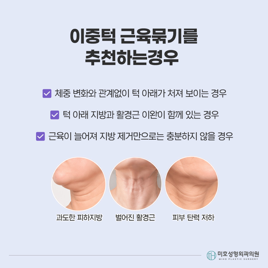 이중턱묶기란? 지방흡입과 차이부터 적합한 경우, 회복 과정까지 관련 이미지 4