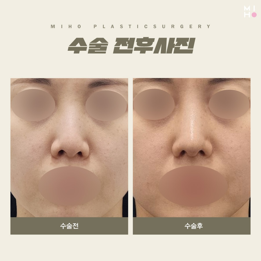 비익거상 깔끔한 과정을 위해서 관련 이미지 7