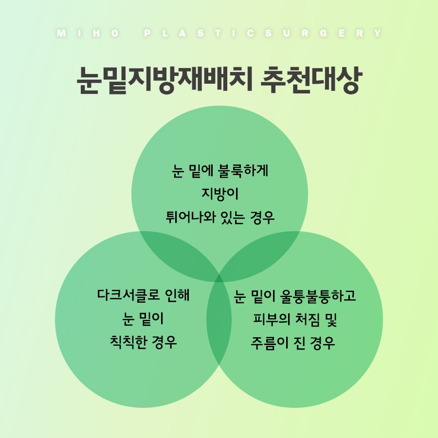 눈밑지방재배치 고민에 맞게 개선하며 관련 이미지 6