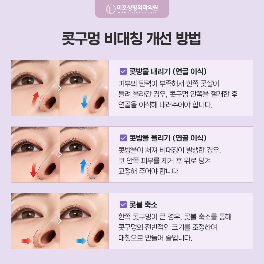 콧구멍짝짝이 원인과 교정 방향 관련 이미지 4