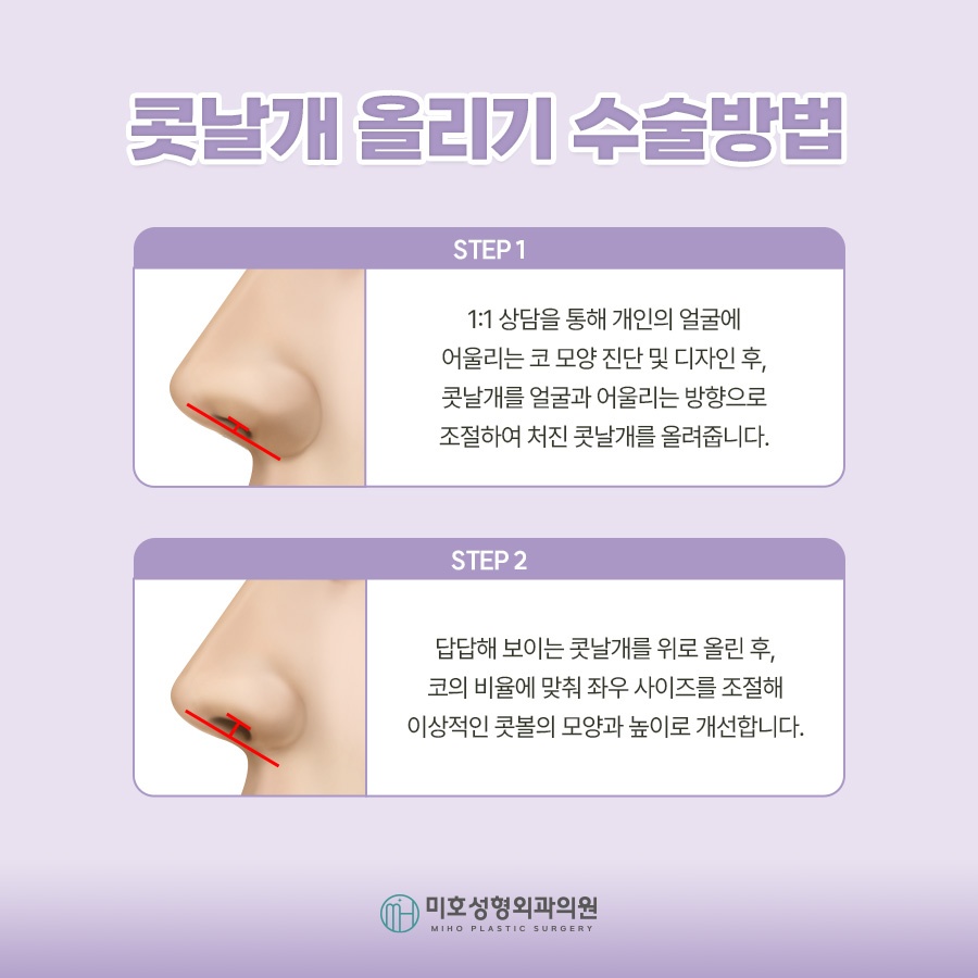 콧날개올리기 개개인에게 맞는 방식으로 관련 이미지 5