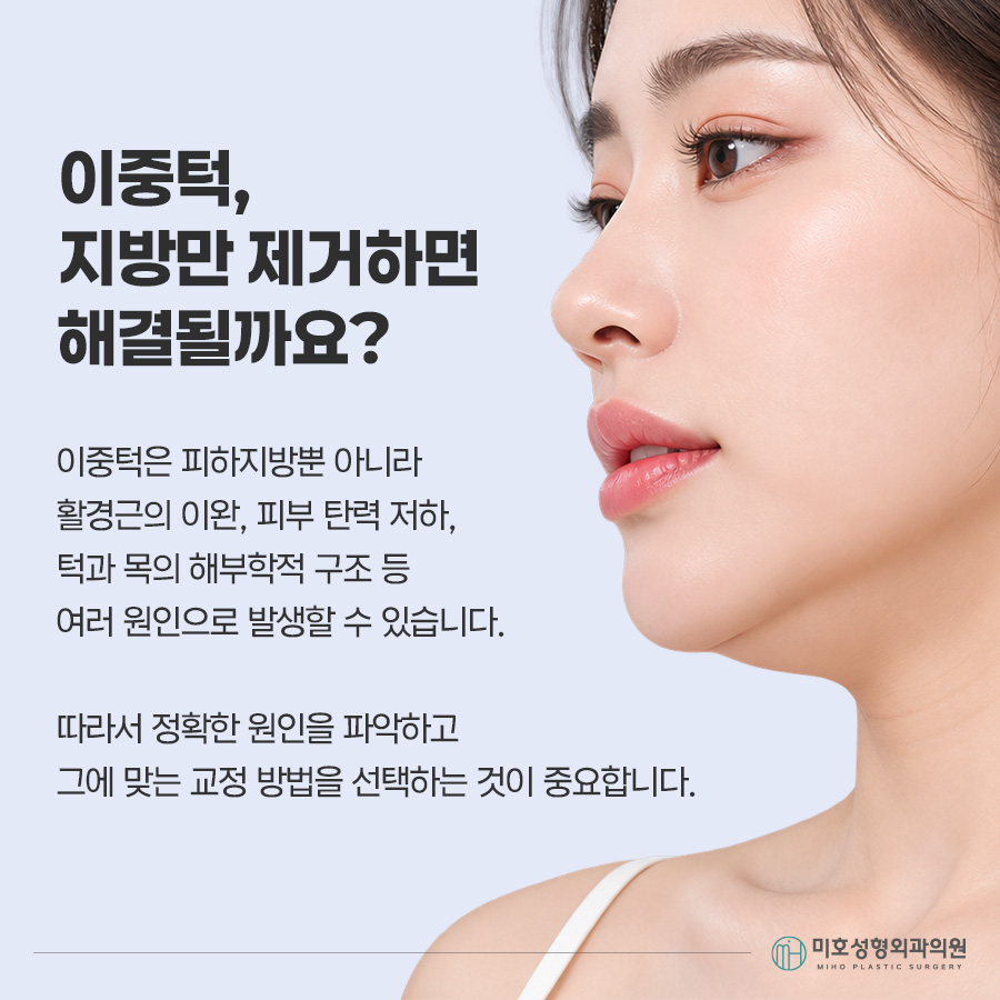 이중턱묶기란? 지방흡입과 차이부터 적합한 경우, 회복 과정까지 관련 이미지 2