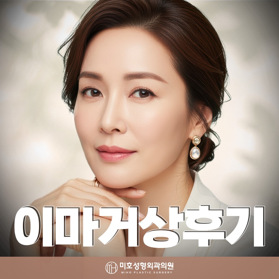 이마거상후기 진행과정 및 체크할 점 관련 이미지 1