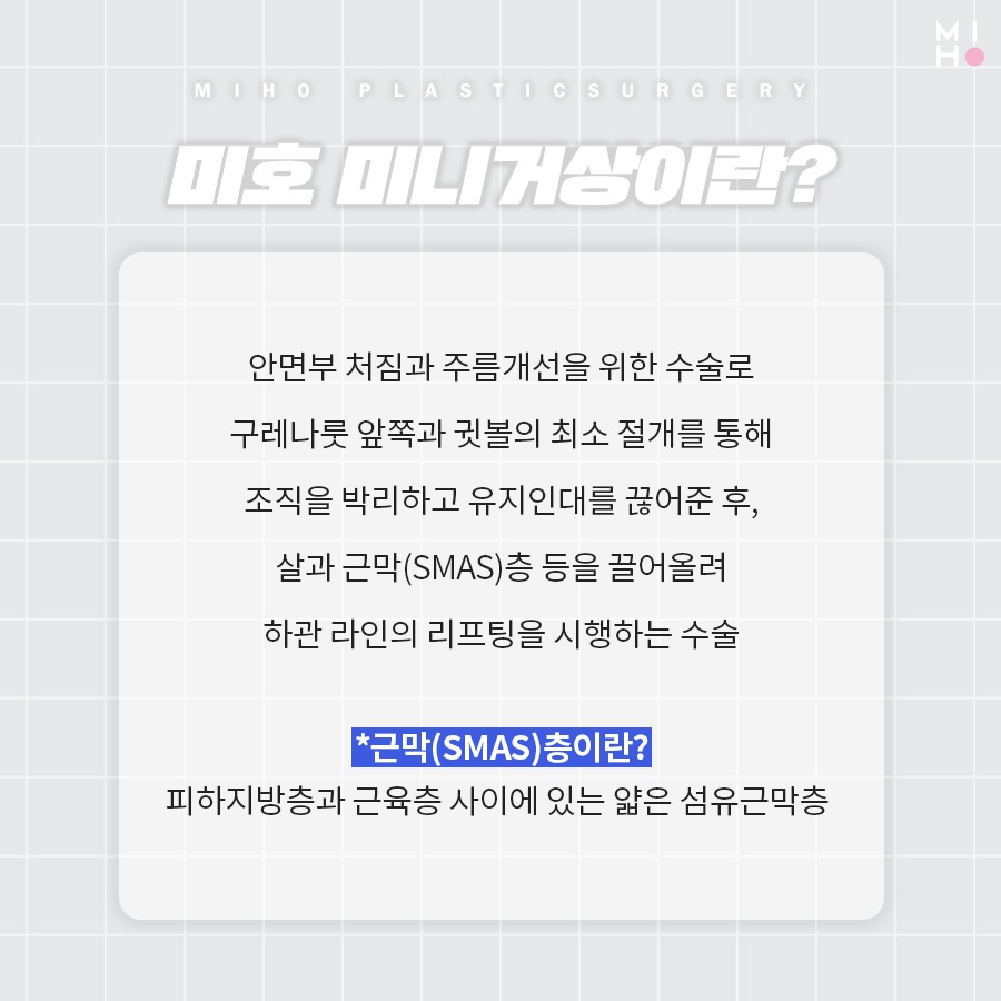 미니거상 처짐이 걱정이라면 관련 이미지 2