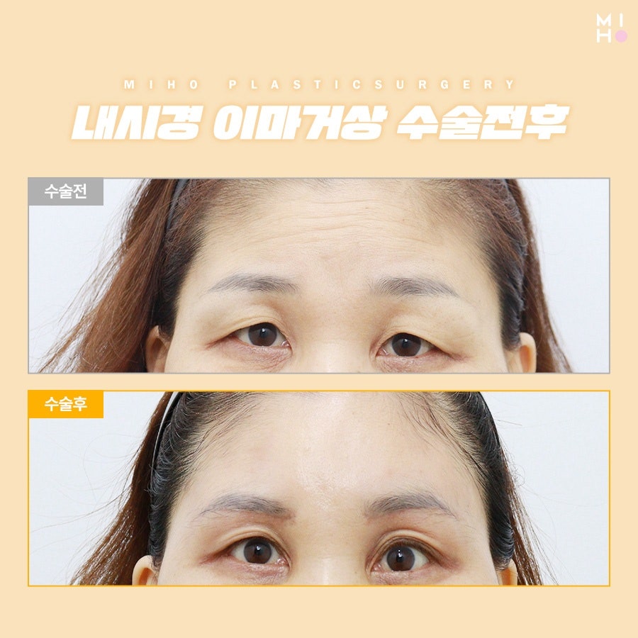 이마거상술후기 고려할 부분은 관련 이미지 20