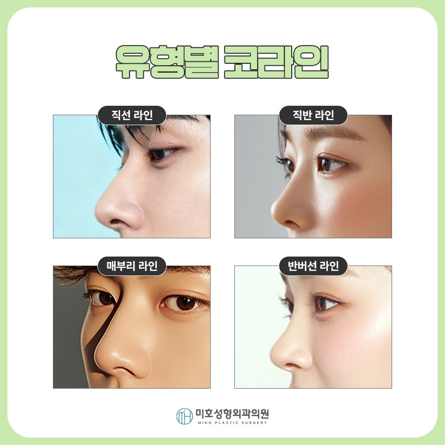 신논현코성형 선택시 고려할 부분들 관련 이미지 6