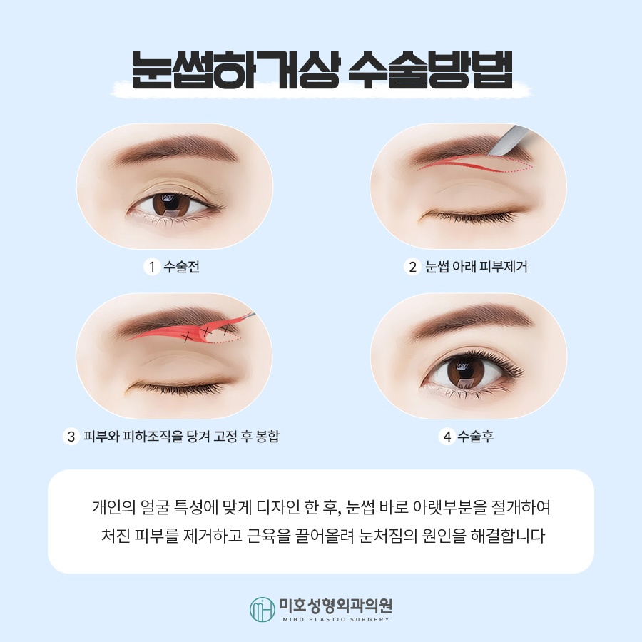 눈썹하거상 노안형 얼굴에 변화를 주려면 관련 이미지 5