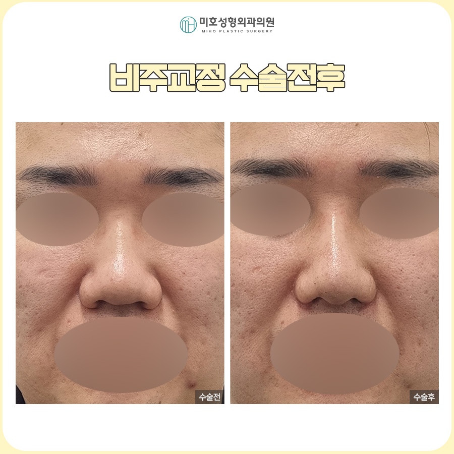 비주내리기 입체적이고 세련된 옆라인을 만드는 방법 관련 이미지 8