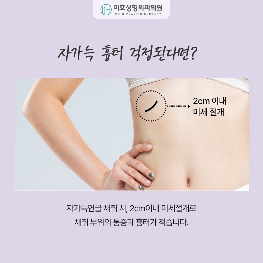 For a Natural-Looking Result with Costal Cartilage Nose Surgery image 5