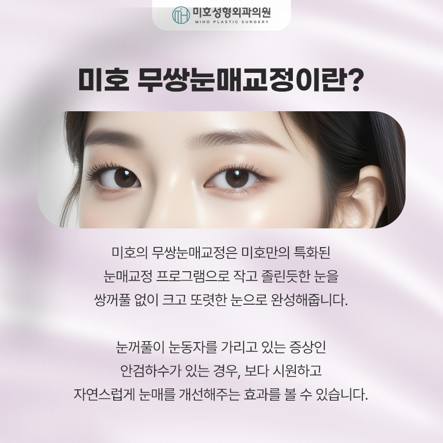How to Make Your Eyes Bigger Without Double Eyelids: Ptosis Correction for Monolids image 2