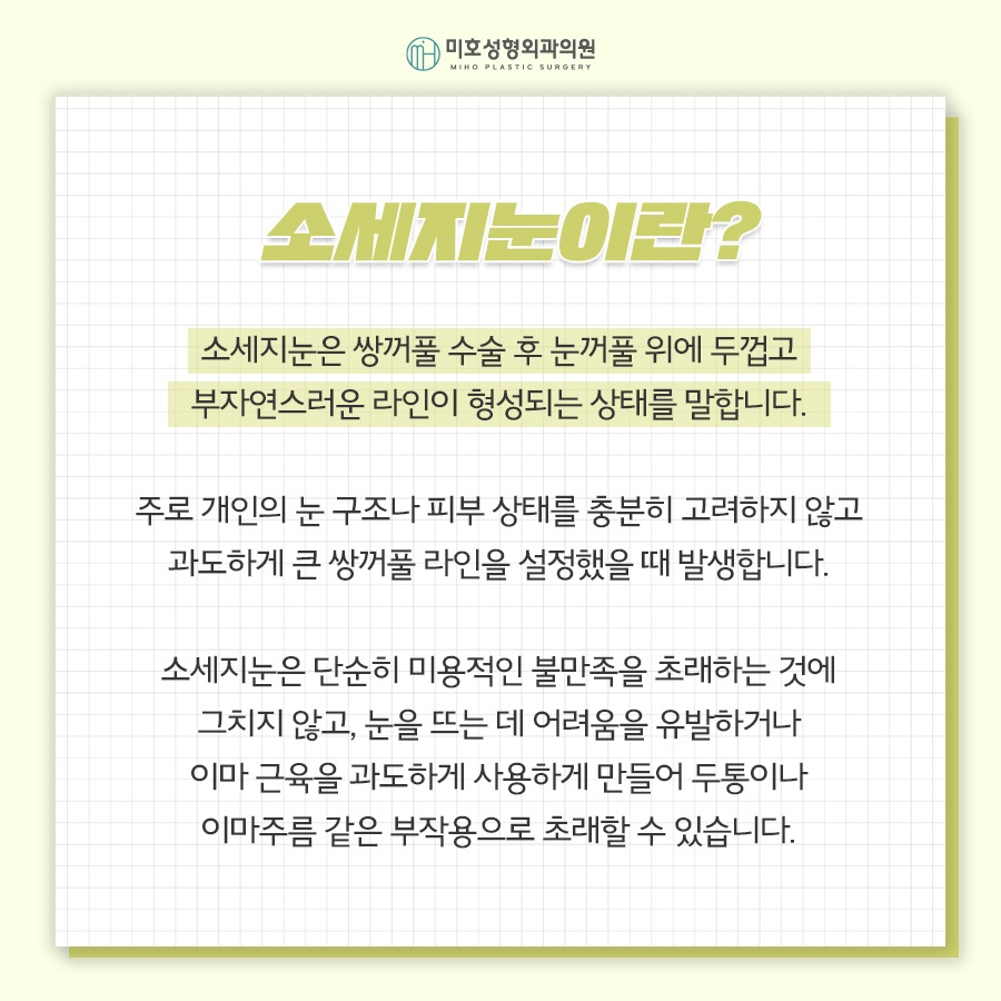 소세지눈재수술 고민된다면 관련 이미지 2
