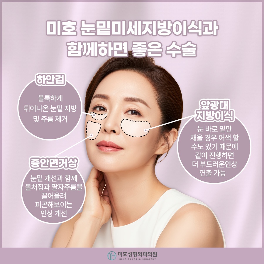 눈밑미세지방이식 올바른 계획으로 관련 이미지 6