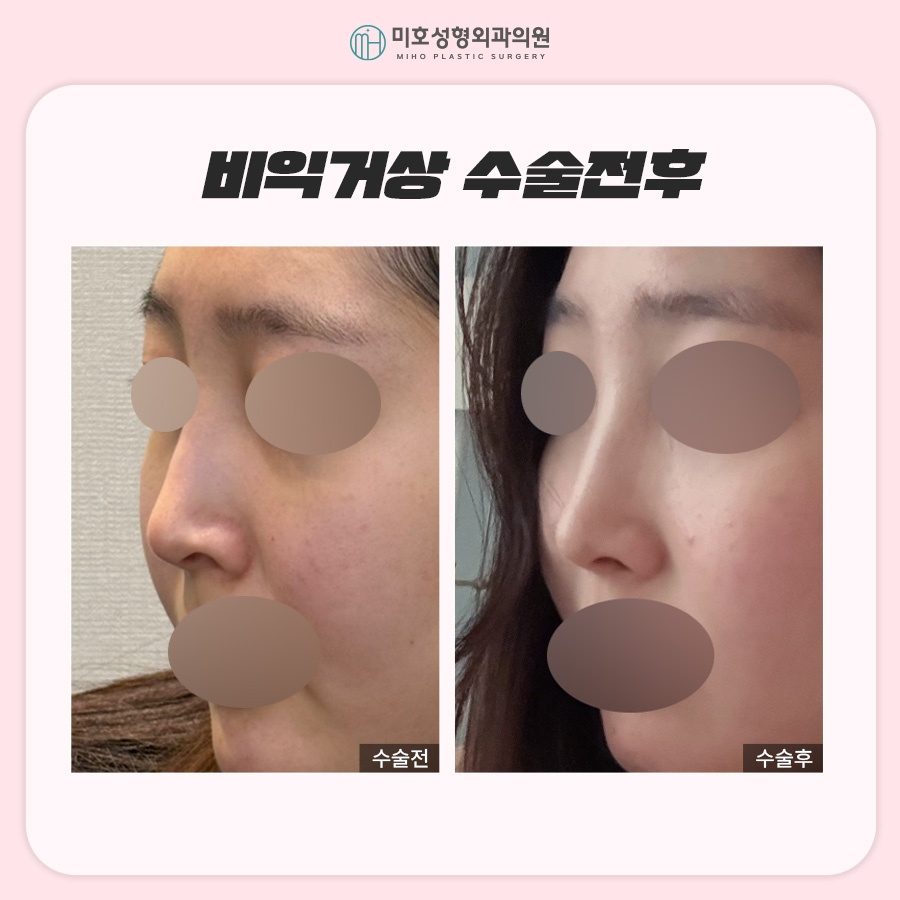 비익거상 맞춤 비율을 찾아주는 미호 관련 이미지 9