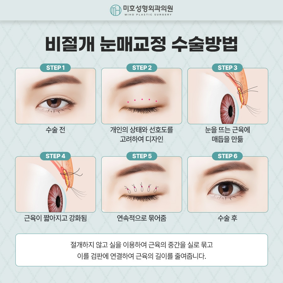 Naturally Defined Eyes with Male Eye-Shape Correction image 4