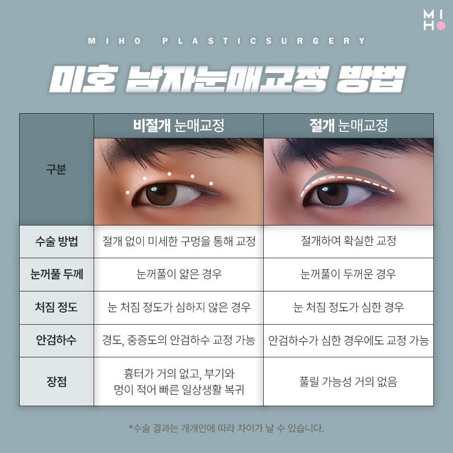 남자눈매교정 무쌍부터 유쌍까지 시원하게 관련 이미지 3