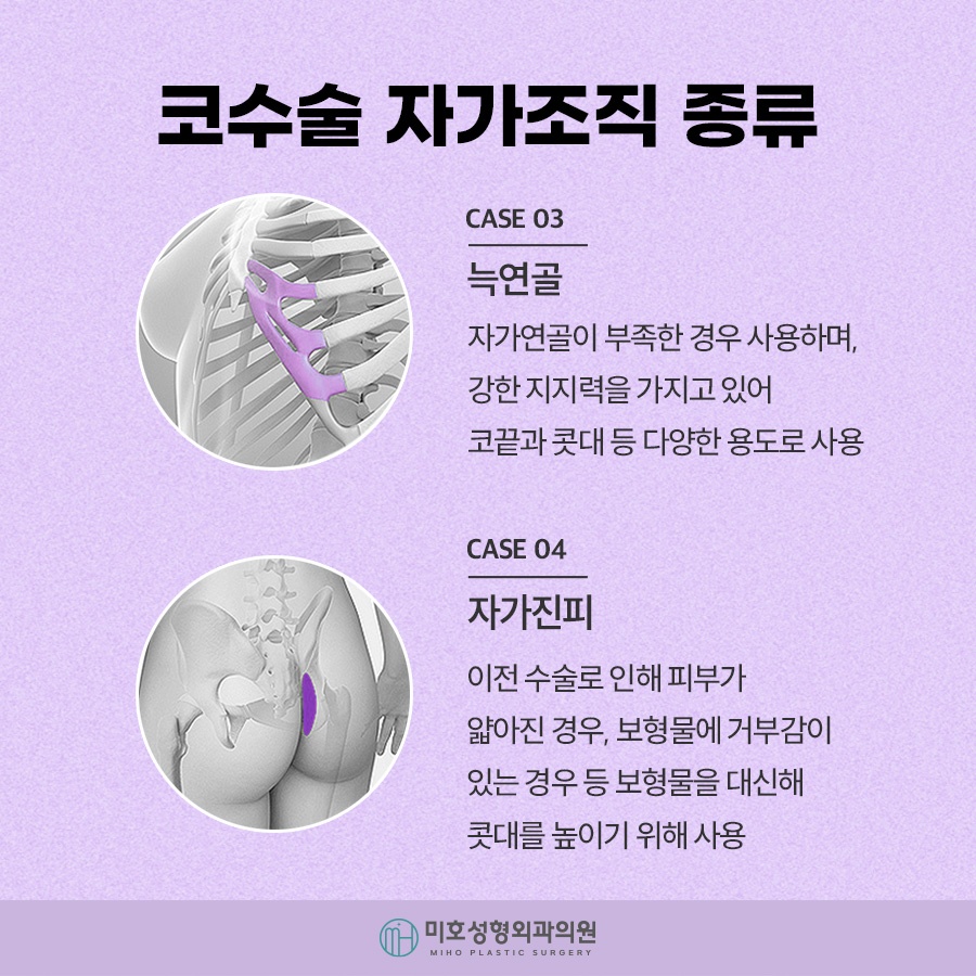 구축코 재시도 신중히 고려하여 관련 이미지 7