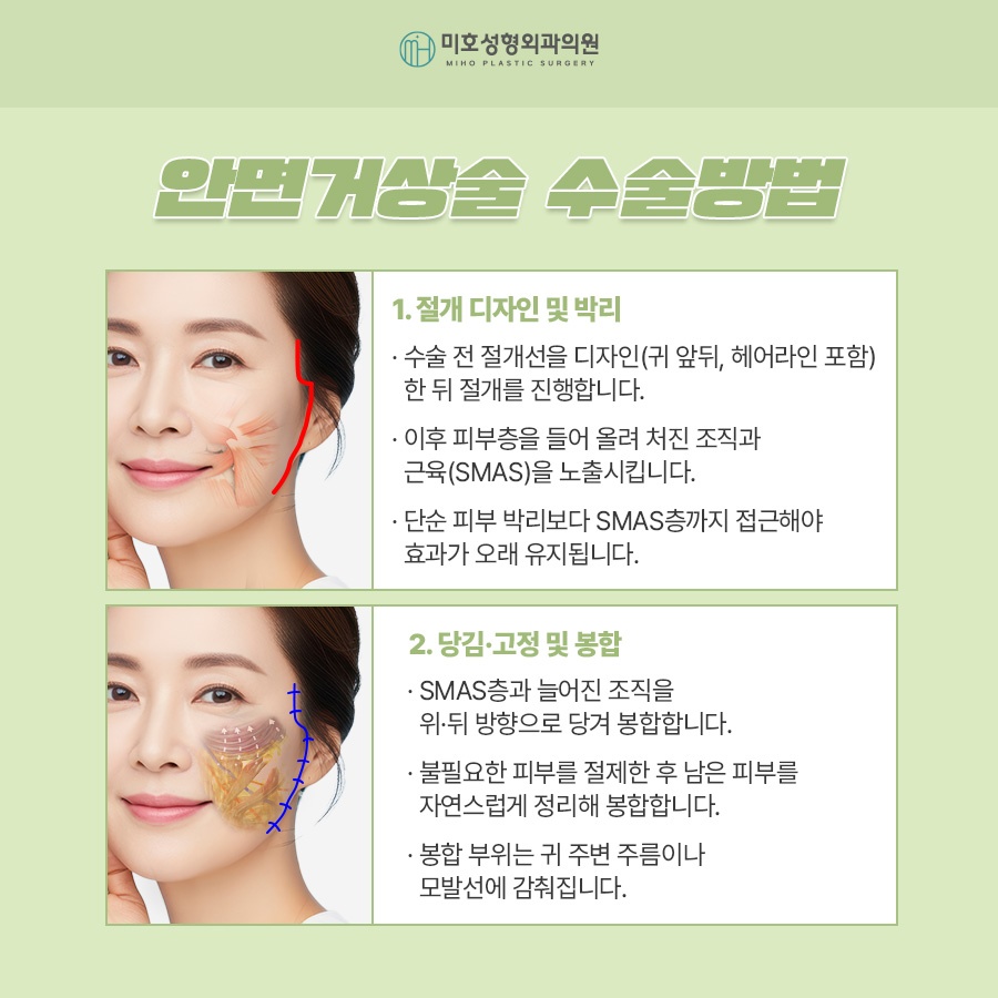 Wondering About the Side Effects of a Facelift? image 4