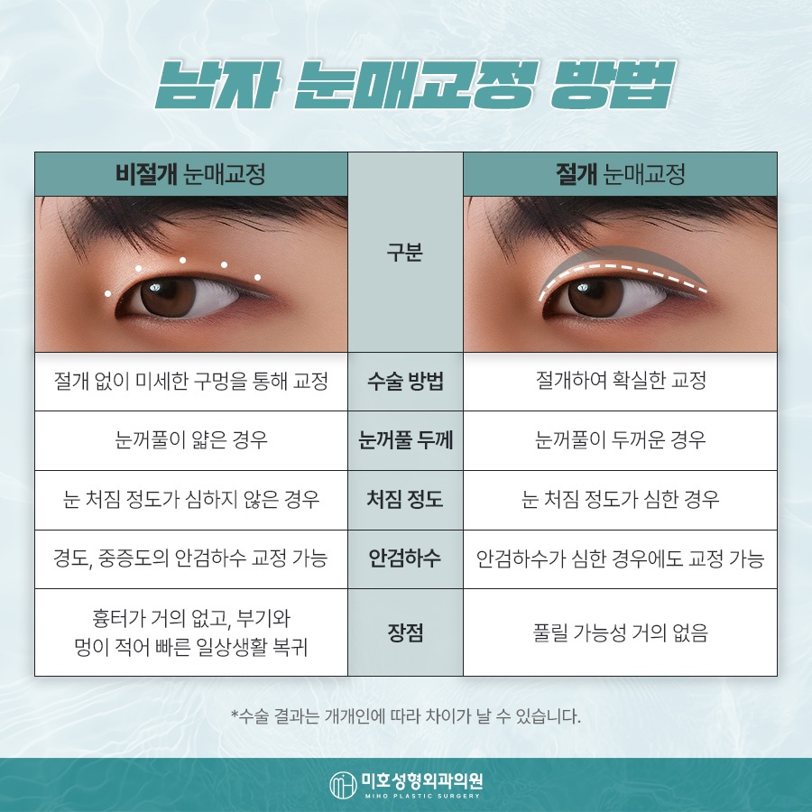 Natural-Looking Male Eye Shape Correction image 3
