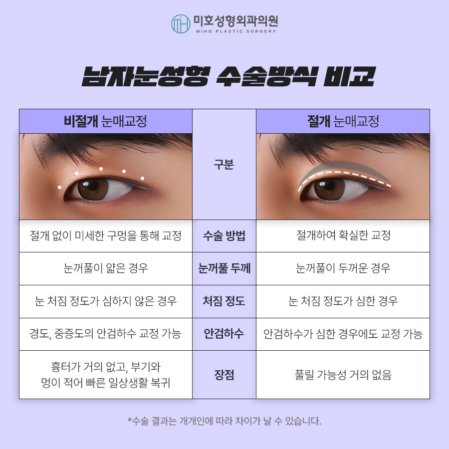 남자눈성형 무쌍눈매교정 특징 알아보기 관련 이미지 5