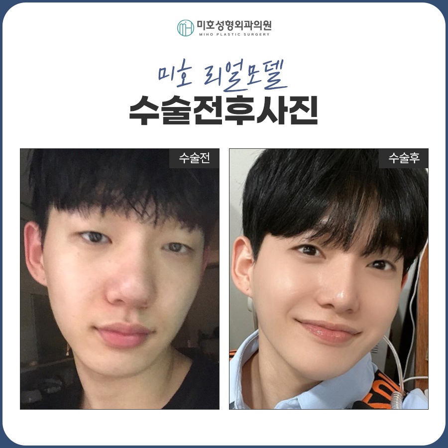 남자코 잘 맞는 이미지로 관련 이미지 8