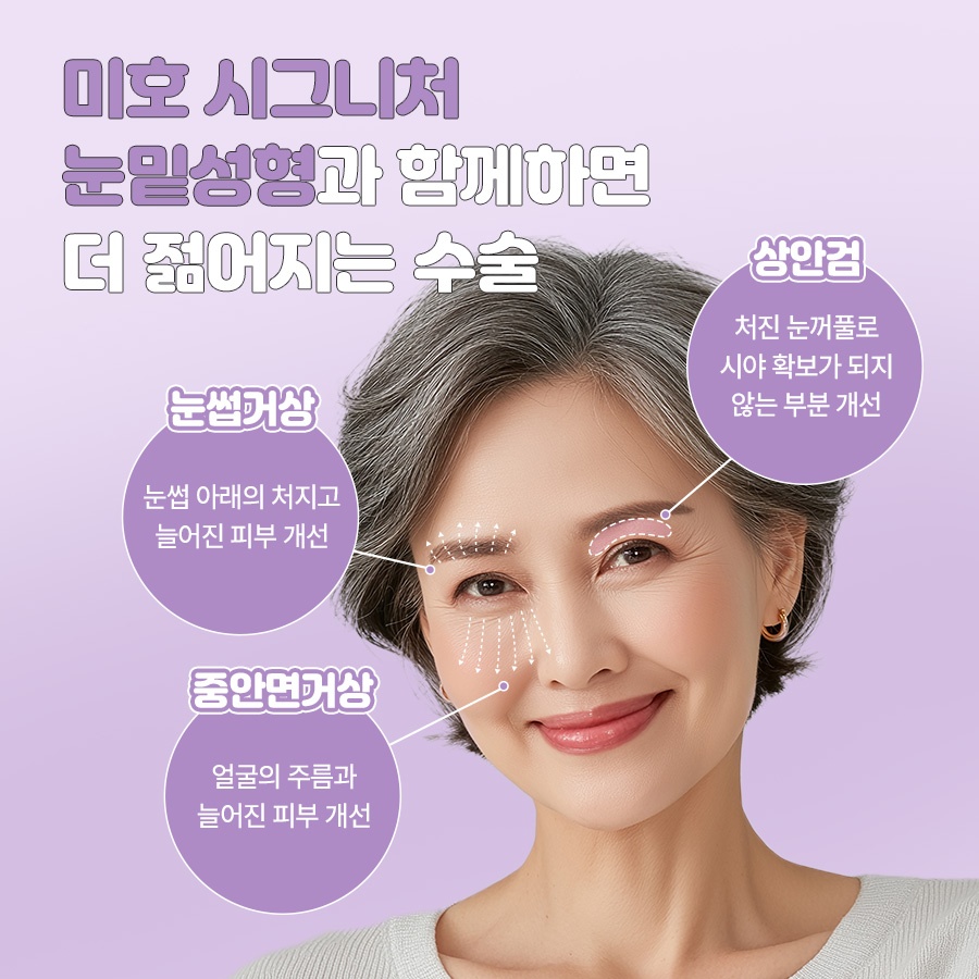 미호 시그니처 눈밑성형 지방재배치 눈매 개선 관련 이미지 5