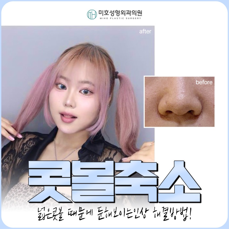 콧볼축소 세밀한 분석을 통해 관련 이미지 1