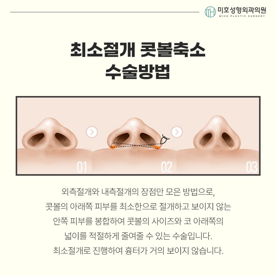 How to Make Your Nostrils Look Smaller: Considering Facial Harmony image 5
