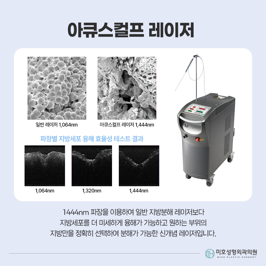 이중턱묶기란? 지방흡입과 차이부터 적합한 경우, 회복 과정까지 관련 이미지 5