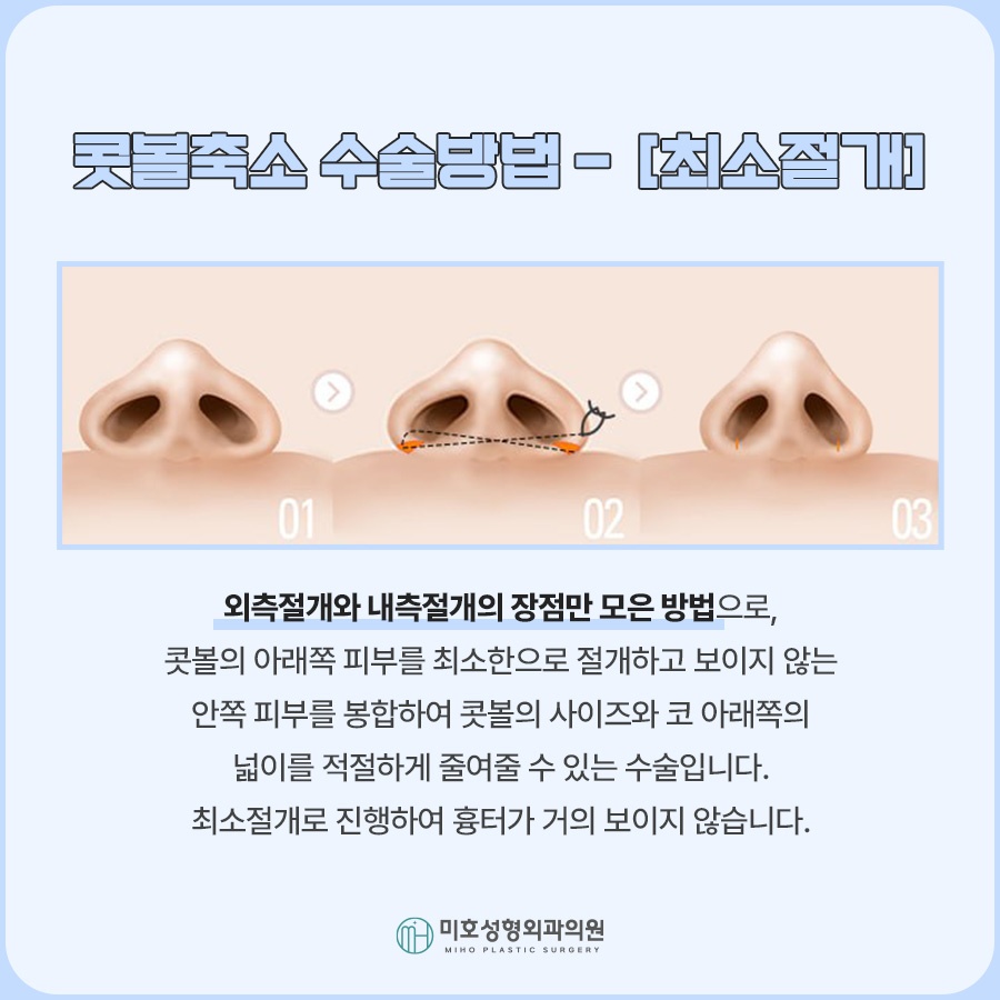 콧볼축소 세밀한 분석을 통해 관련 이미지 6