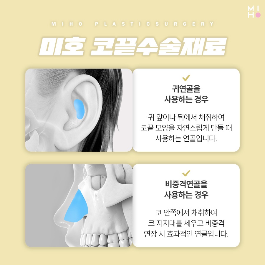 Considering Harmony in Tip Rhinoplasty image 3