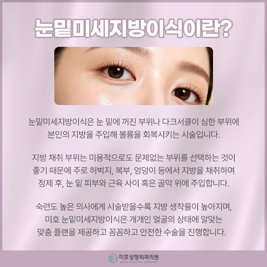 눈밑미세지방이식 올바른 계획으로 관련 이미지 2