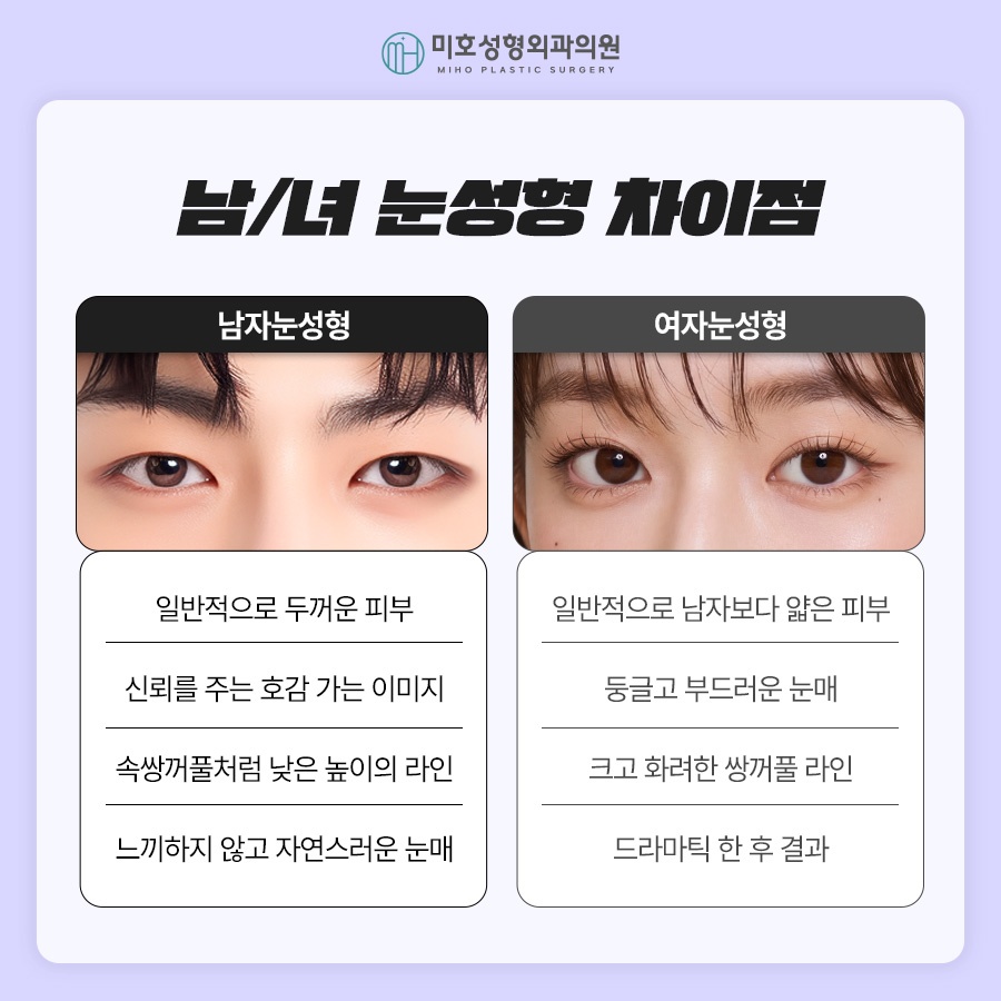 남자눈성형 무쌍눈매교정 특징 알아보기 관련 이미지 3