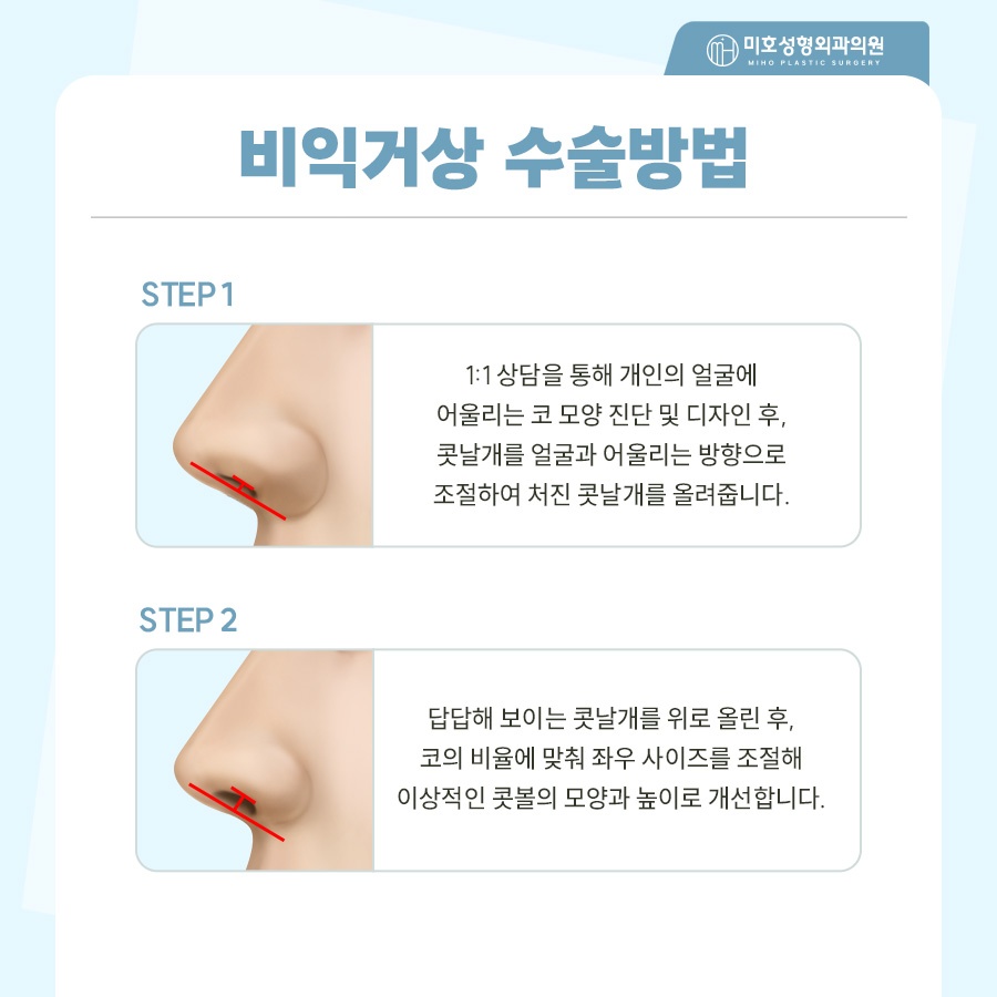 비익거상 개개인별 맞는 비율로 관련 이미지 5