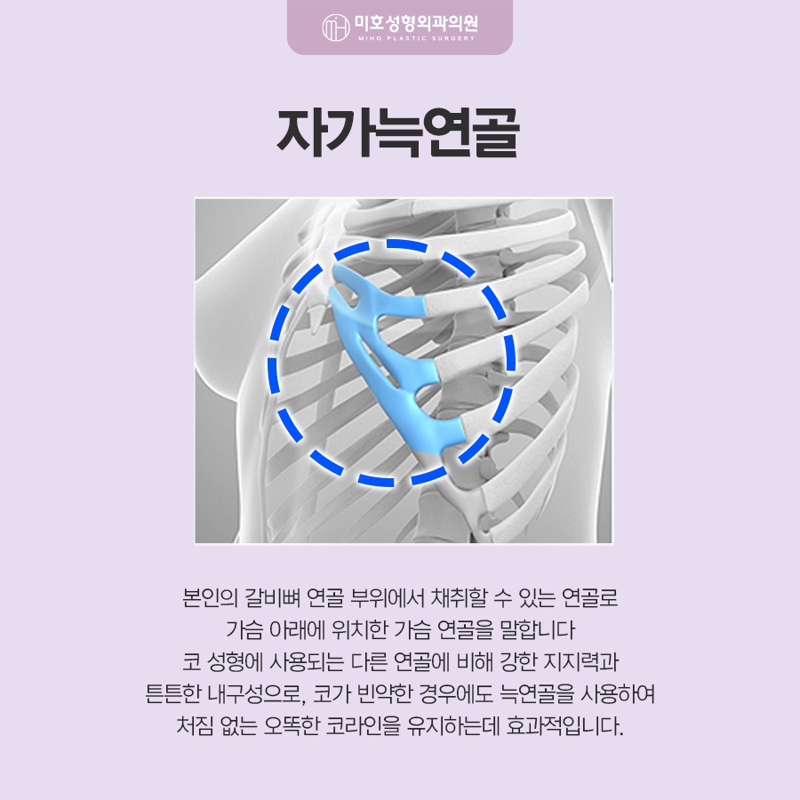 자가늑코수술 흉터와 통증이 걱정된다면 관련 이미지 2