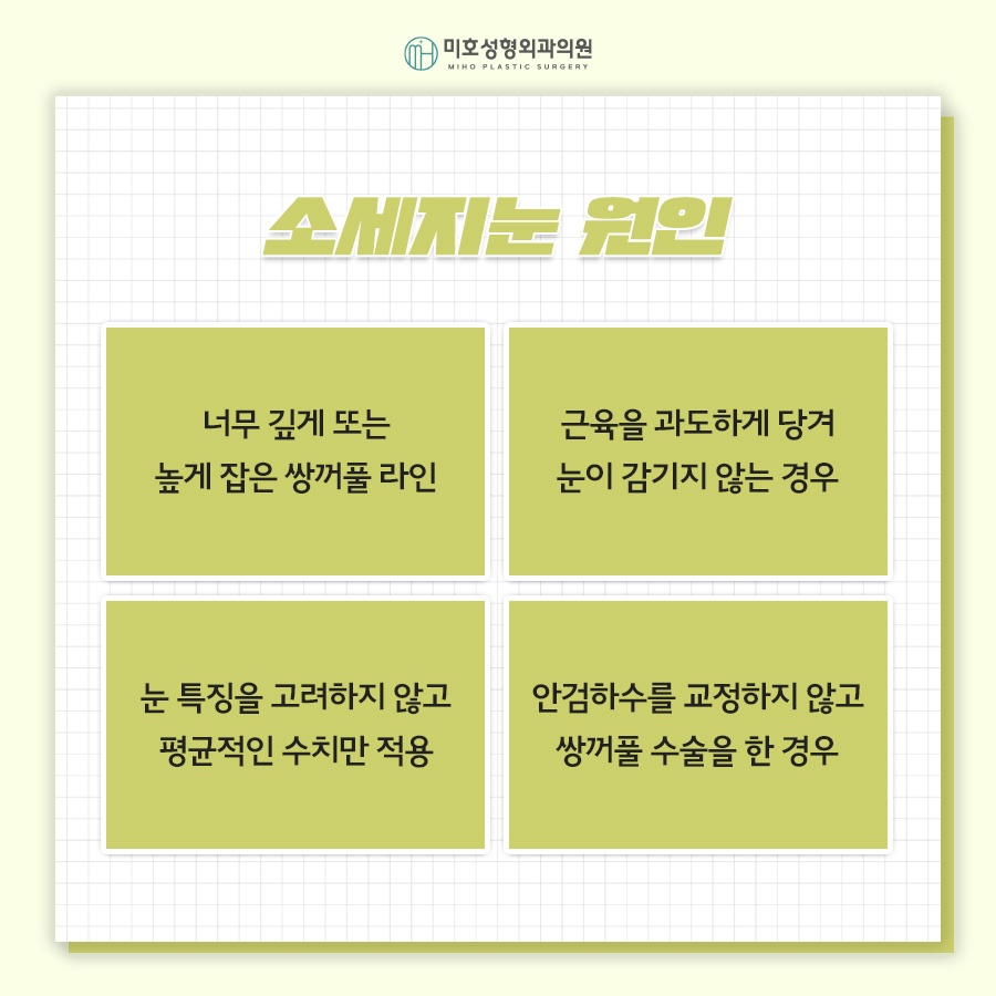 소세지눈재수술 고민된다면 관련 이미지 4