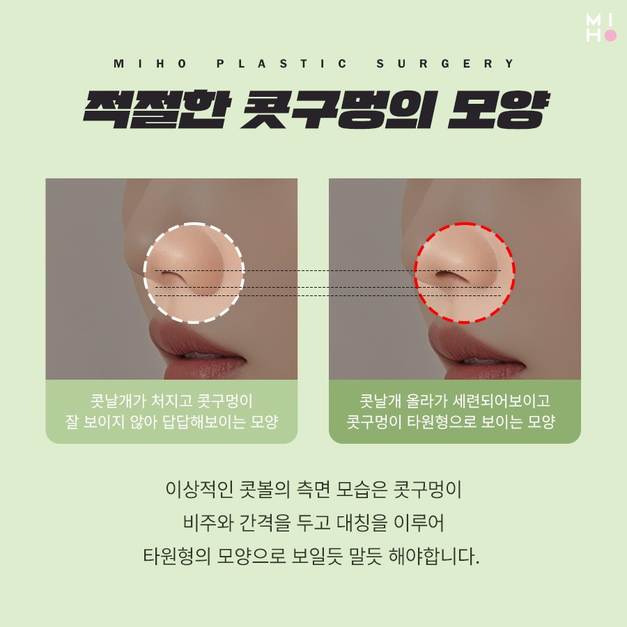 Who Should Consider Alar Lifting, and How Is It Done? image 4