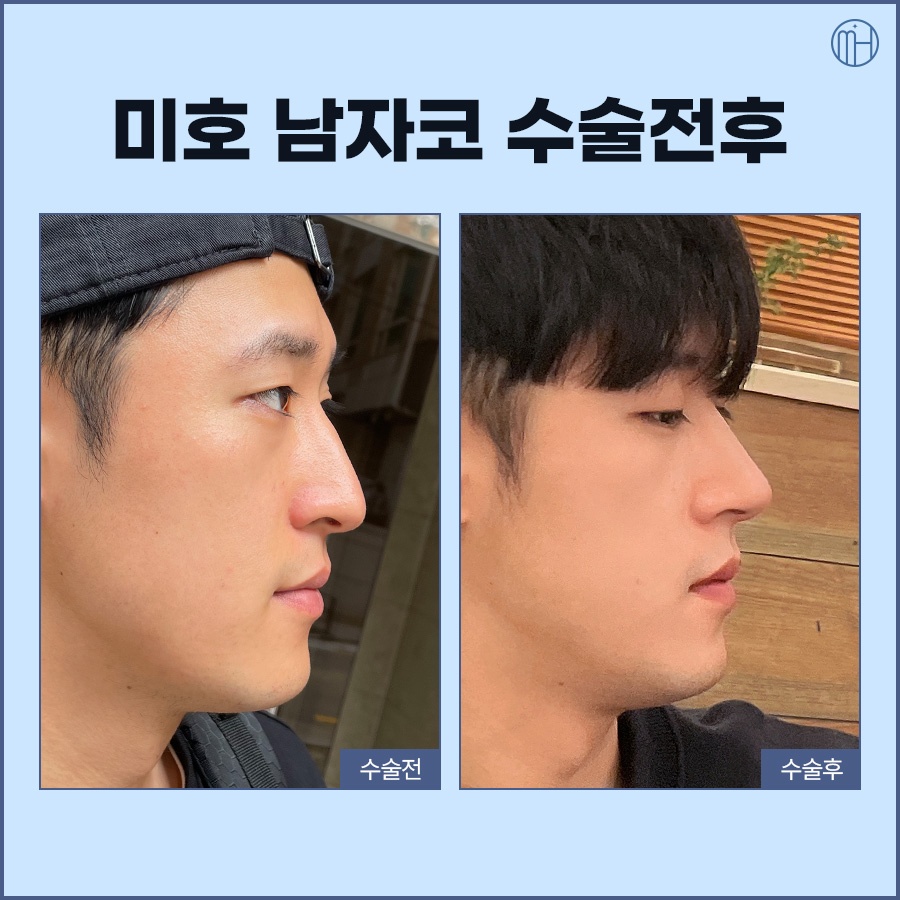 A Different Approach to Male Noses and Female Noses image 8