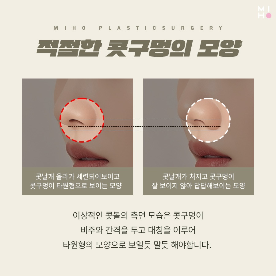 비익거상 깔끔한 과정을 위해서 관련 이미지 4