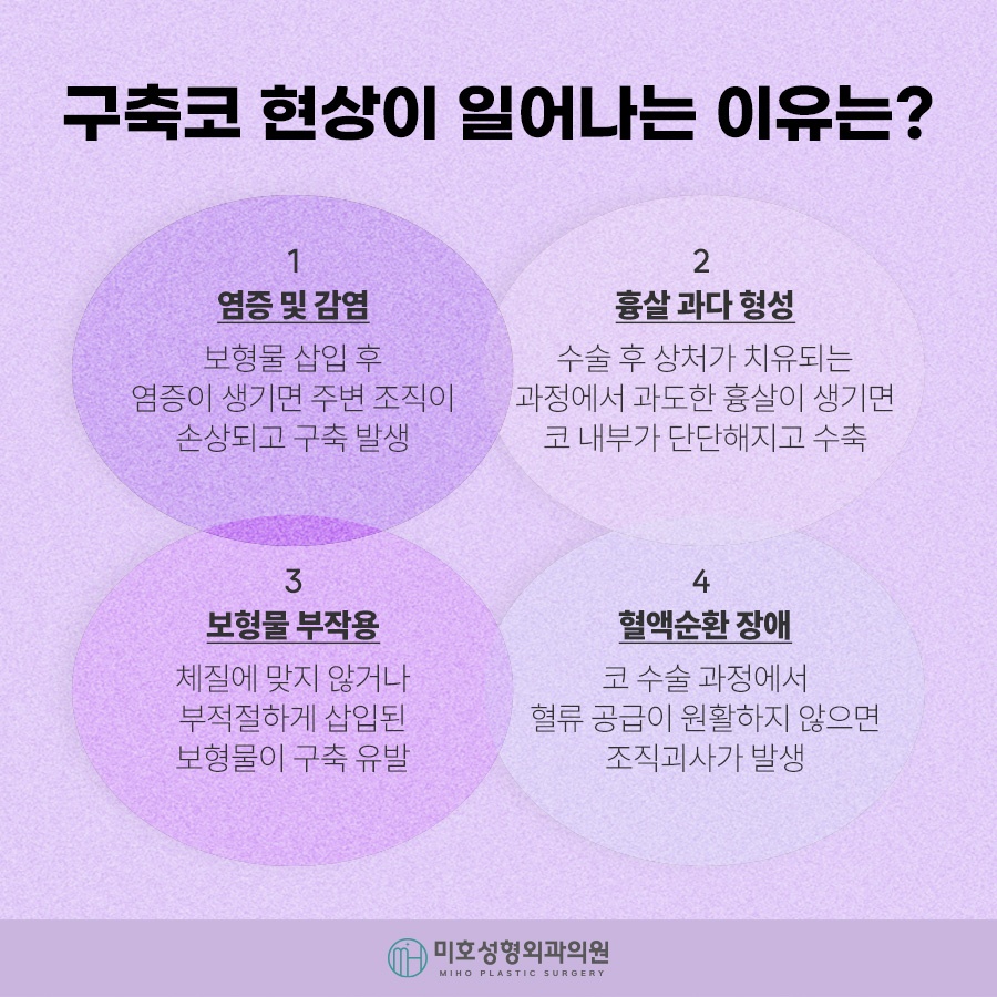 구축코 재시도 신중히 고려하여 관련 이미지 3