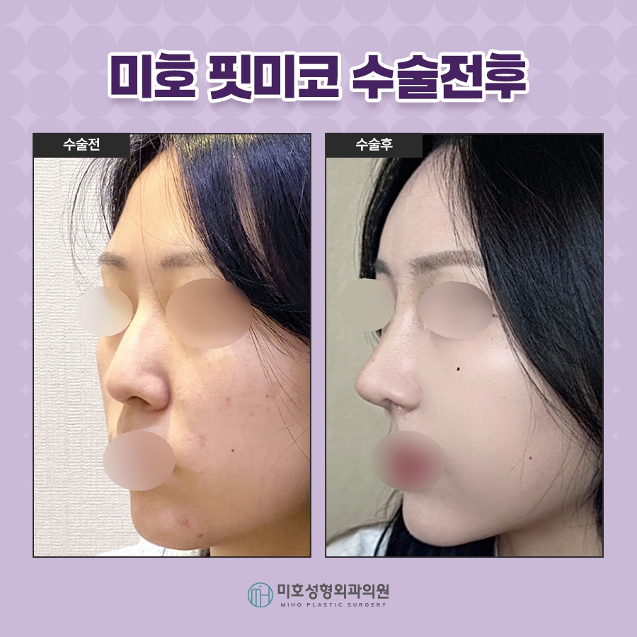 Fit Me Nose, Naturally and Beautifully image 8
