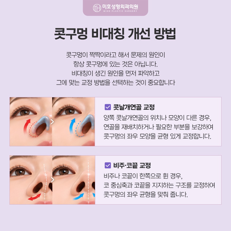 콧구멍짝짝이 원인과 교정 방향 관련 이미지 3