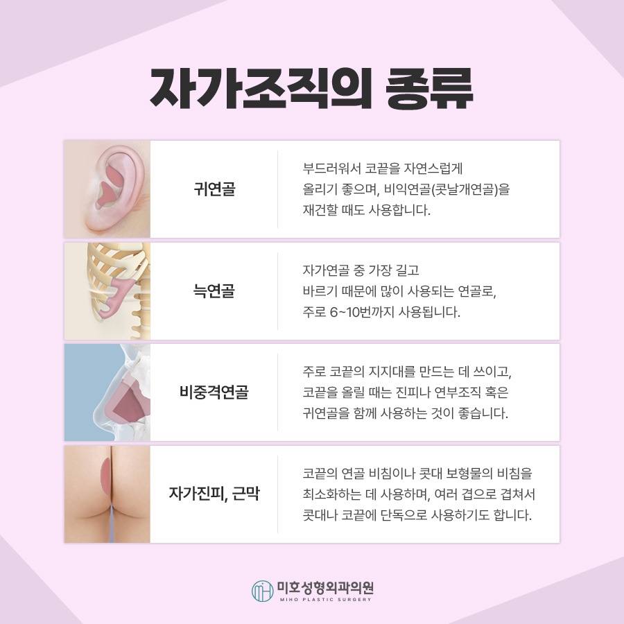 무보형물코수술 자연스러운 라인을 원한다면 관련 이미지 4