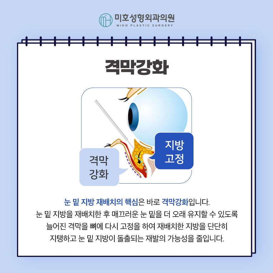 Miho Signature Lower Eyelid Fat Repositioning: The Beginning of Youth image 3