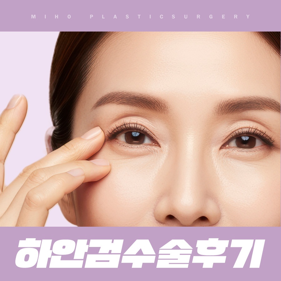 하안검수술후기 주인공이 되는 법 관련 이미지 1