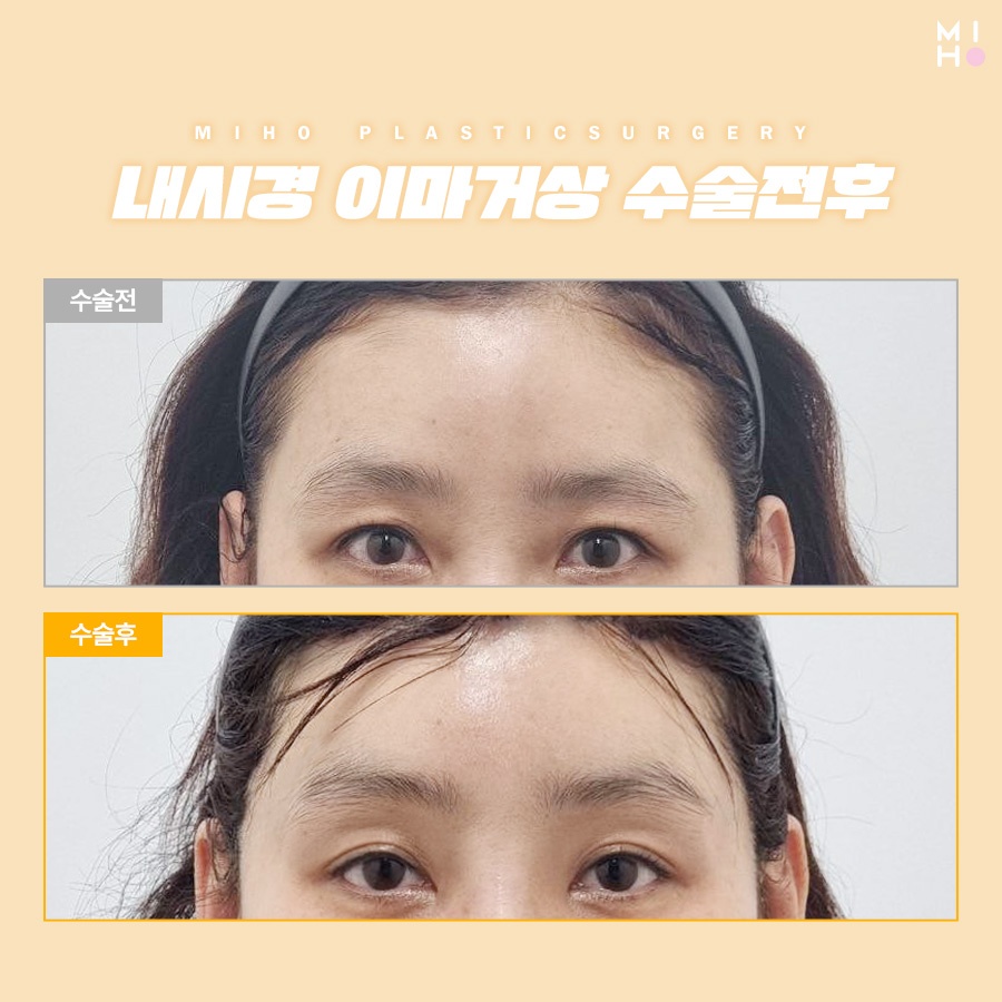 이마거상술후기 고려할 부분은 관련 이미지 6