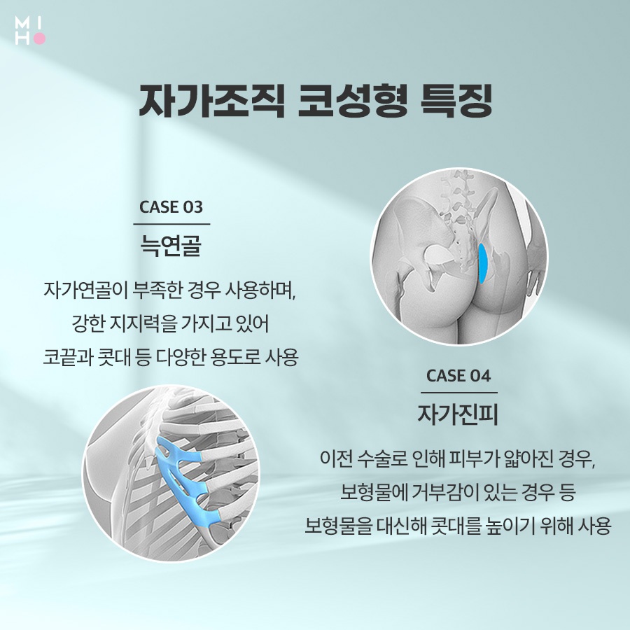 When Is Improvement for a Contracted Nose Needed? image 7
